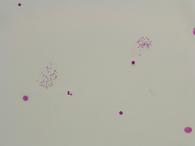 Male Chromosomes Slides - Male Chromosomes 04 100X